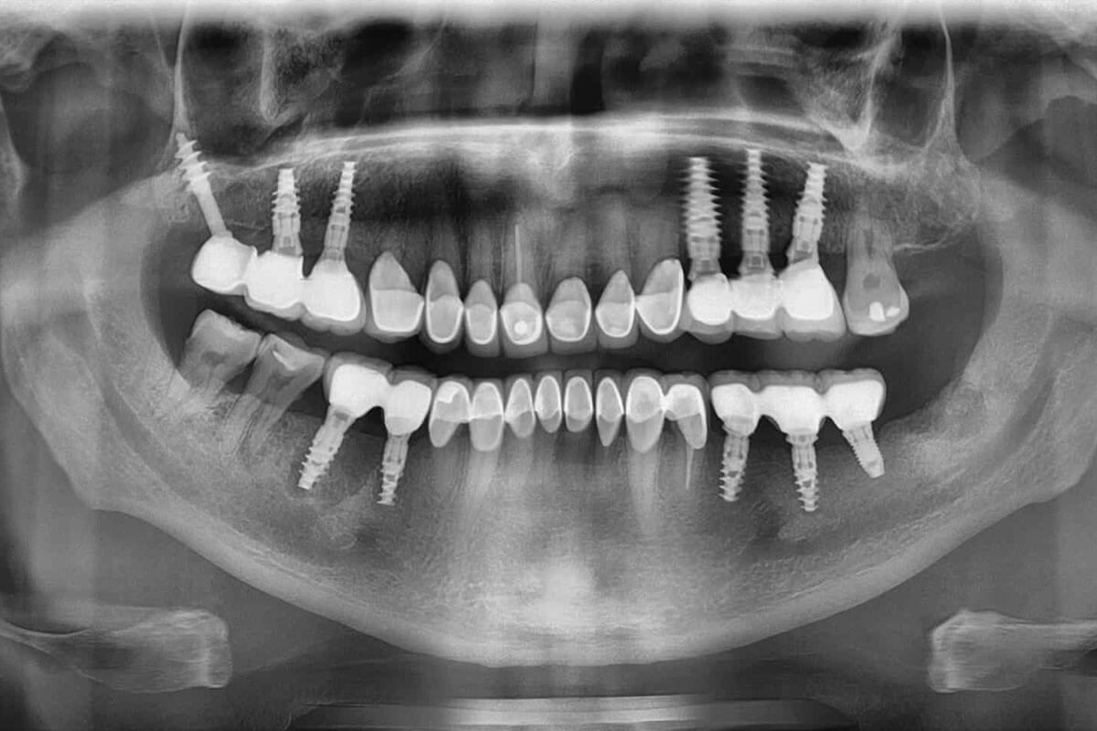 Лечение зубов в Пушкино: комплексный обзор